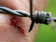 MITI&SALUTE/ Tetano: non solo ruggine!