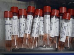 Test molecolari ancora negativi per il Lecce