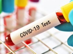 Lecce, positivi al Covid-19 un calciatore e un membro dello staff