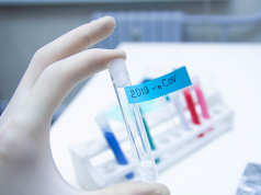 Test molecolari Lecce, esito indeterminato per i 2 calciatori positivi